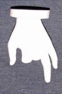 義肢の事例3 (患部)